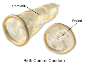 External Condom