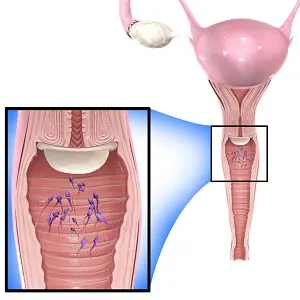 Diaphragm