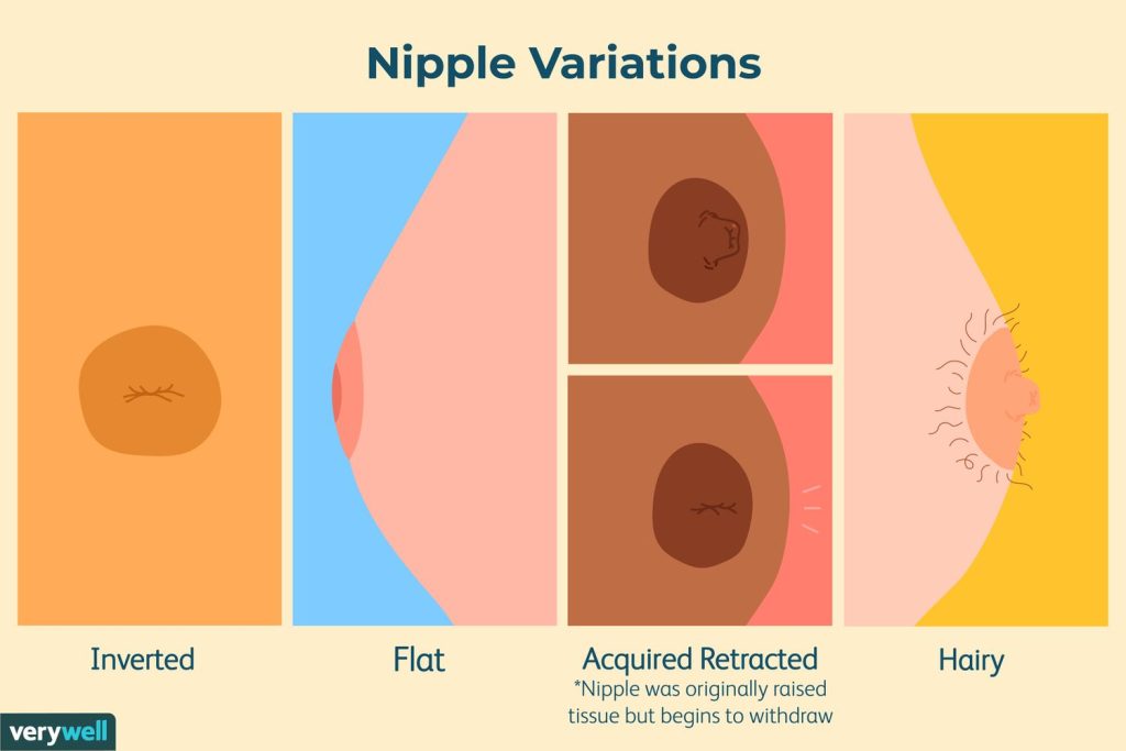 Different Types of Nipples (Source: VeryWellHealth)