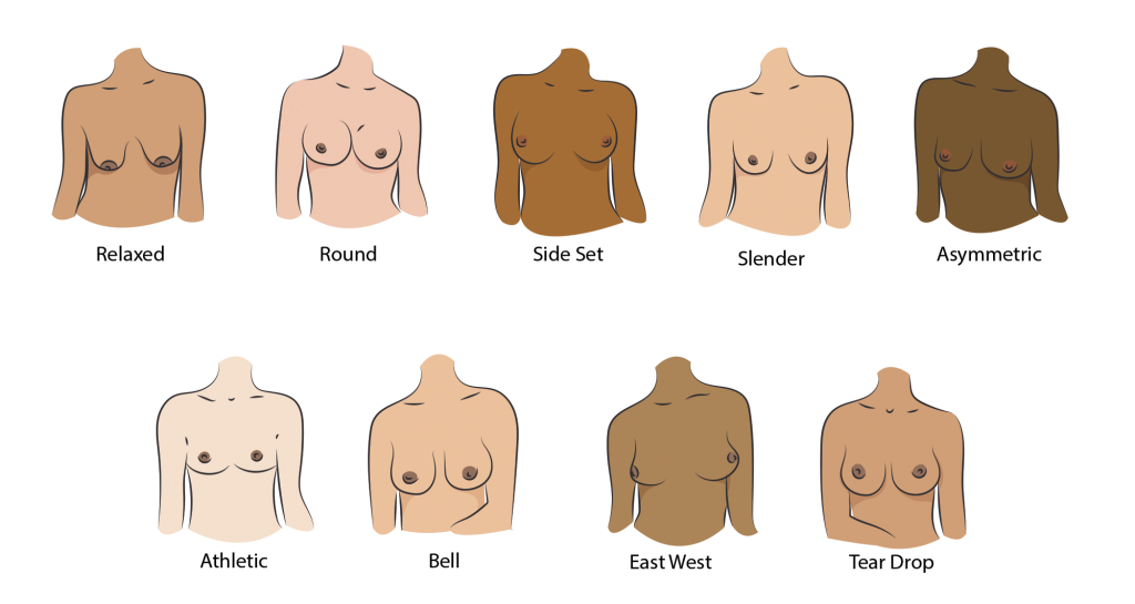 The Breast Is Yet To Come – Breast Changes & Red Flags - Pratisandhi