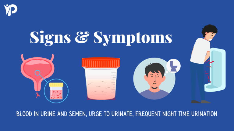 Graphic of "Signs and Symptoms" of Prostate Cancer with blood in urine, blood in semen, urge to urinate, frequent night time urination